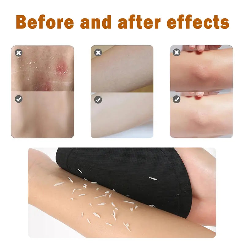 Body Exfoliating Pads –Lift Away Built-Up Skin for a Smoother Feel