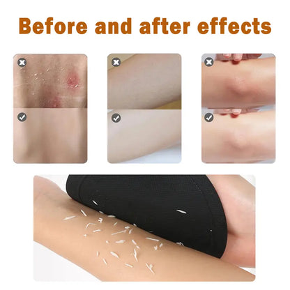 Body Exfoliating Pads –Lift Away Built-Up Skin for a Smoother Feel